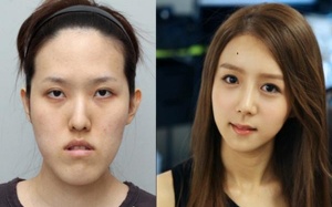 Đớn đau vì... nhan sắc