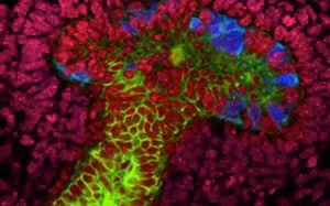 Tạo cấu trúc thận tí hon từ tế bào gốc