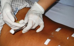 Hỗ trợ điều trị bệnh  mạn tính bằng nhu châm