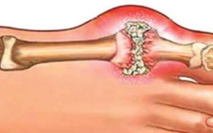 Tác dụng thực sự của sản phẩm Hoàng Thống Phong?