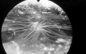 Bồ công anh nở hoa... trong tai bé một tuổi