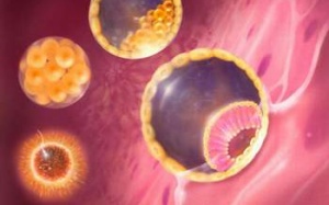 Chửa trứng và biến chứng ung thư nhau thai