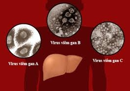 Tự kiểm tra xem mình có dễ mắc bệnh viêm gan A