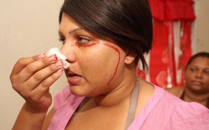 Kinh hoàng thiếu nữ đổ mồ hôi và khóc ra máu