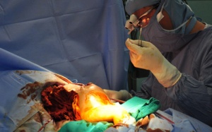 Đóng thành ngực cho bé Phi Phụng