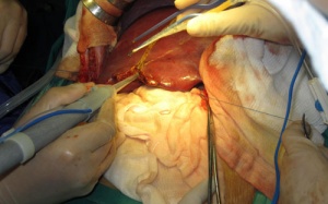 “Giáo sư chăn lợn” và những kỳ tích của y tế Việt Nam