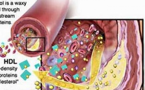Tầm soát và khám miễn phí bệnh rối loạn lipid - máu