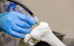 Bút sinh học “vẽ” liền xương