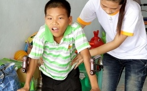 2/3 nạn nhân chất độc da cam có thể phục hồi