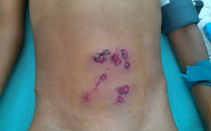 Cứu bé trai bị 10 vết thương do súng tự chế