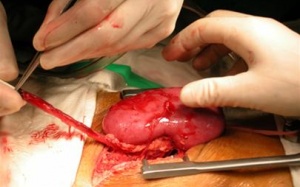 Điều tra 1 bác sĩ đưa bệnh nhân qua Trung Quốc mua thận