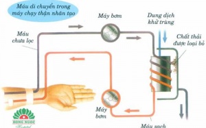Máy chạy thận tự chế - Hy vọng mới cho bệnh nhân nghèo
