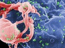 Phát hiện kinh hoàng: Tái phát HIV sau khi khỏi AIDS