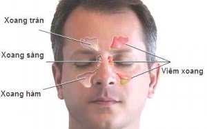 Thuốc điều trị viêm mũi xoang