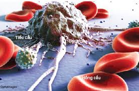 Cứu bệnh nhân ung thư máu bằng tế bào gốc của người khác