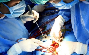 Hội thảo khoa học quốc tế về điều trị bệnh tim mạch