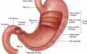 Những điều nên và không nên làm khi bị đau dạ dày