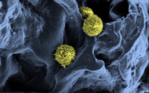 Nghiên cứu thành công tủy xương nhân tạo