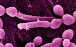 12 bệnh dễ lây nhiễm qua đường tình dục