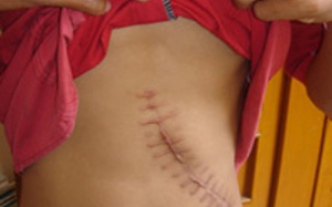 Rộ tin đồn bắt cóc trẻ em đưa sang Trung Quốc bán nội tạng