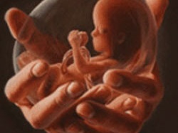 Phát hiện vi khuẩn gây sinh non