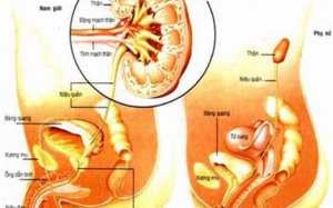 Viêm đường tiết niệu: Nhiều biến chứng nguy hiểm
