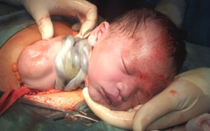 'Tràng hoa quấn cổ' nguy hiểm thế nào?