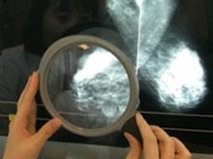 Đột phá trong điều trị ung thư buồng trứng ác tính