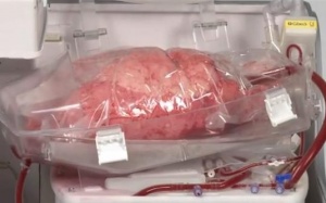 Cuộc 'cách mạng' điều trị: duy trì hoạt động của phổi ngoài cơ thể