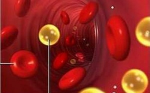 Rối loạn lipid máu: Ăn gì?
