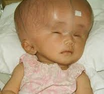 Những hội chứng oái oăm trong lịch sử nhân loại