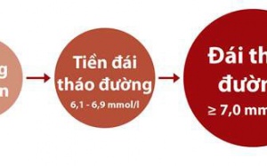 Xử trí tiền đái tháo đường