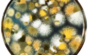 Bệnh nấm sâu Aspergillus có nguy hiểm?