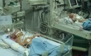 Giây phút sinh tử khi tách rời hai trái tim bé nhỏ thông nhau