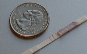 Giấy thử ung thư qua nước tiểu