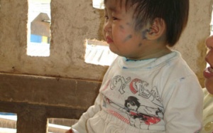 Phòng bệnh cho trẻ khi thủy đậu vào mùa