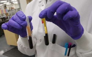 Xét nghiệm máu 1 lần, chẩn đoán sức khỏe trong 5 năm