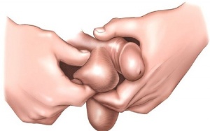 Tự phát hiện ung thư tinh hoàn trong 5 phút