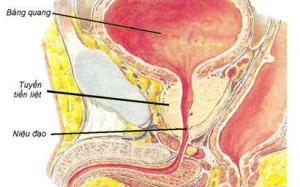 Bệnh của nam giới cao tuổi