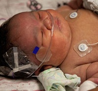 Bé sơ sinh chết 28 phút bỗng sống lại