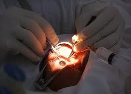 Bình Định: Mổ mắt miễn phí cho 100 bệnh nhân nghèo