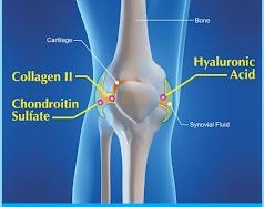 Glucosamin chẳng bổ béo gì cho viêm khớp gối