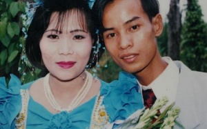 Người đàn ông mang hình hài của…cóc