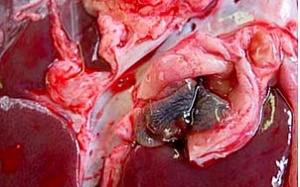 10 tỉnh, thành có ca bệnh sán lá phổi