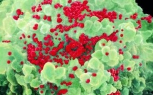 Ca nghi nhiễm HIV hiếm có giữa đôi đồng tính nữ