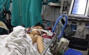 Bé trai 8 tuổi nguy kịch vì bị bố đánh bằng điếu cày