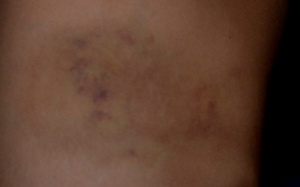 Học sinh lớp 2 không dám đến trường vì sợ... cô giáo đánh