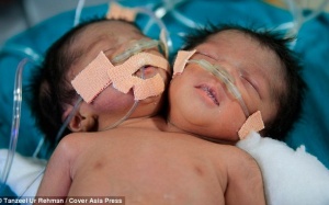 Ấn Độ: Hai bé sinh đôi chưa được gặp mẹ