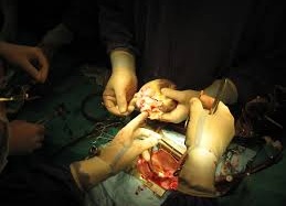 Ghép tạng: 1 người cho trăm người chờ