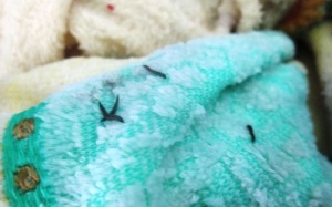 “Sinh vật lạ” trong khăn tắm là ấu trùng không gây hại